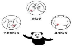 體檢查出結(jié)節(jié)，真的會(huì)癌變嗎？別慌，這樣處理就對(duì)了！